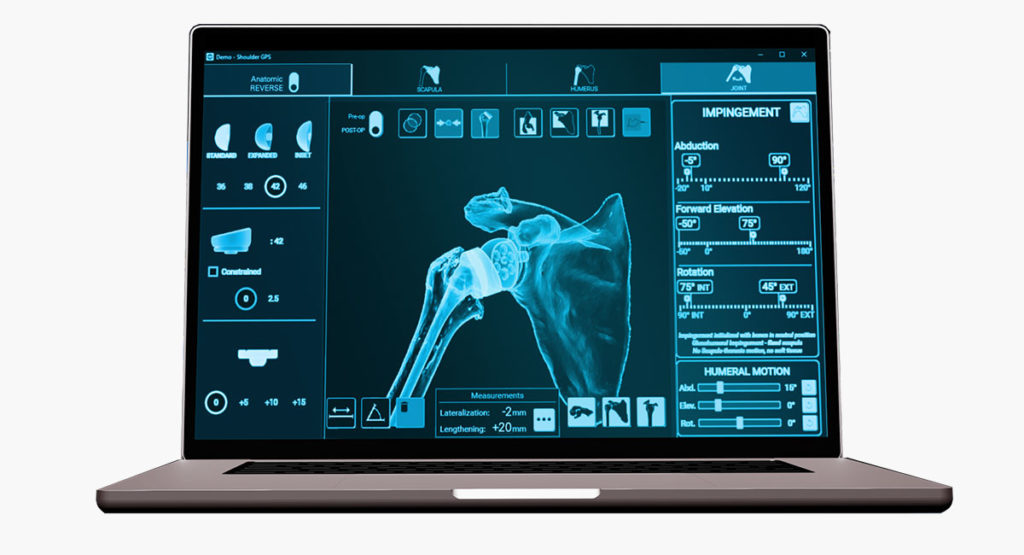 Equinoxe Shoulder Planning App
