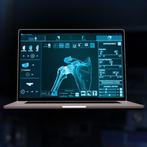 Exactech Shoulder Planning App